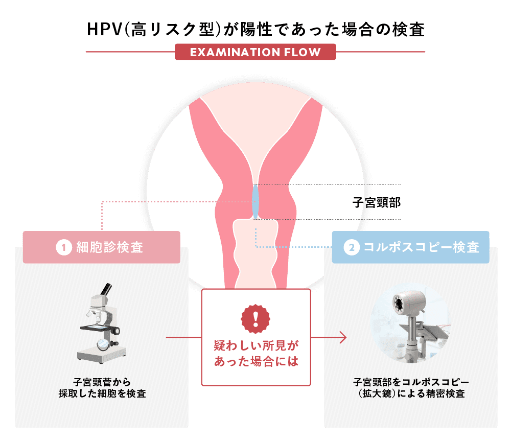 HPV(高リスク型)が陽性であった場合